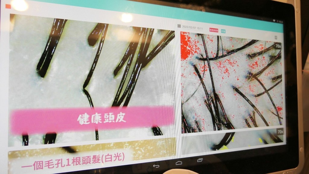 台北頭皮養護中心推薦