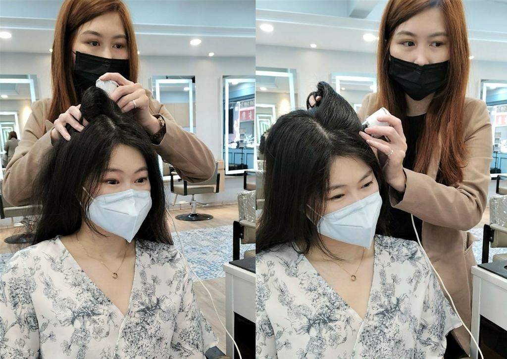 內湖頭皮檢測